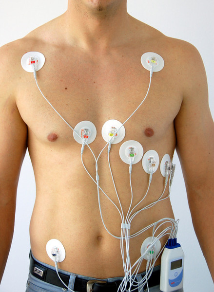 What is a 24 hour Holter Monitor? 